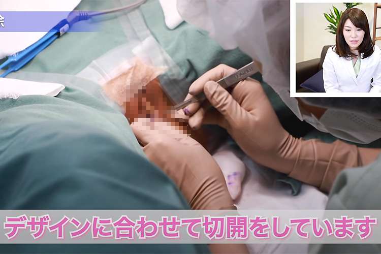 【閲覧注意】小陰唇縮小手術の施術風景、ビラビラを切り取って性器を整える様子【ゆりりん先生の美容チャンネル】