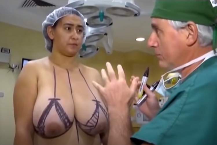 垂れ乳爆乳熟女がオッパイを小さくする手術を受ける様子【Dr. Pedro Vidal】