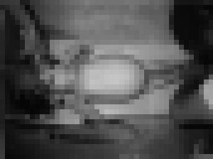 【閲覧注意】 世界最年少で妊娠した少女・・・お前らの想像を絶対に超えるぞ（画像あり）