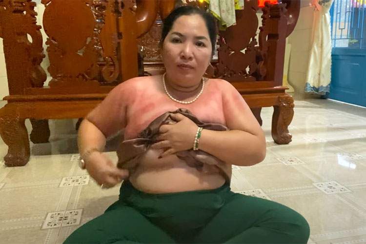 例のベトナム人熟女セラピストさん、セルフかっさ施術中に乳首ポロリ